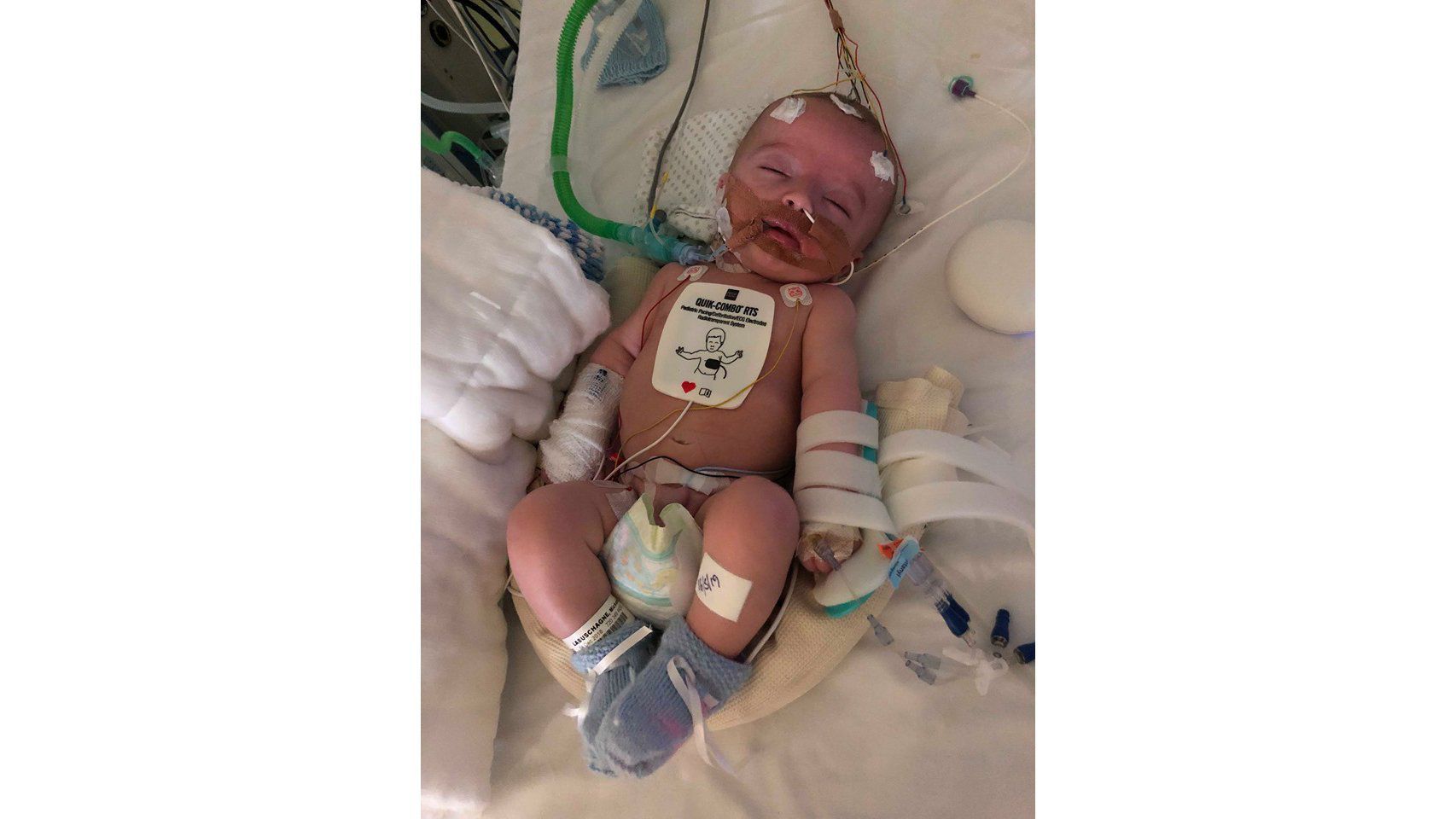 A baby woke up from a coma and smiled at his dad. Now his family is raising money to save his life
